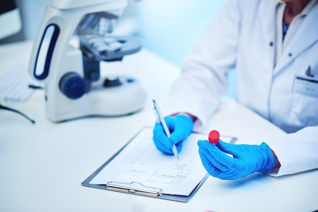Lab technician wearing gloves and holding a plastic specimen cup while writing notes.