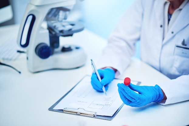  Lab technician wearing gloves and holding a plastic specimen cup while writing notes.