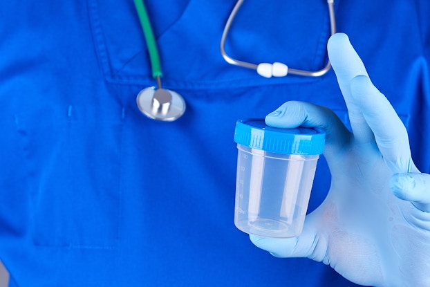  person in scrubs holding specimen cup